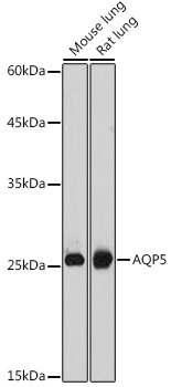 Western blot analysis of extracts of various cell lines using AQP5 Polyclonal Antibody at 1:1000 dilution.