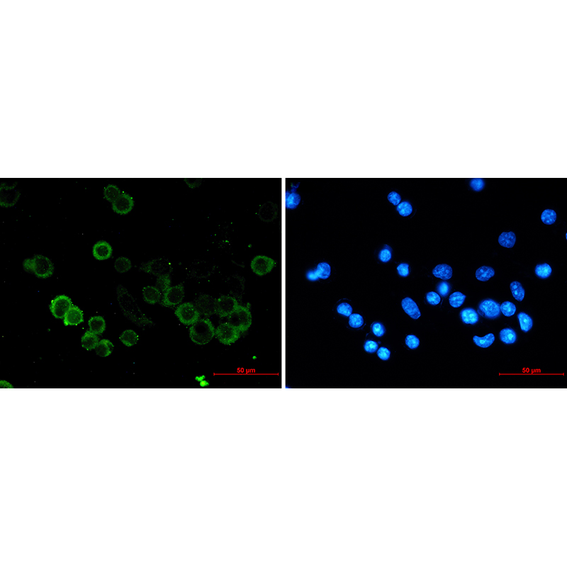 Immunofluorescence of E Cadherin (green) in MCF-7 using E Cadherin antibody at dilution 1:20, and DAPI(blue)