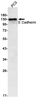 Western blot detection of E Cadherin in PC3 cell lysates using E Cadherin Rabbit mAb(1:1000 diluted).Predicted band size:98kDa.Observed band size:80-120(cleavages),130kDa.
