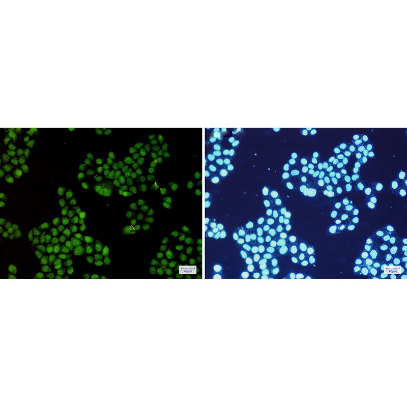 Immunofluorescence of CDK2(green) in Hela cells using CDK2 Rabbit mAb at dilution 1:200, and DAPI(blue)