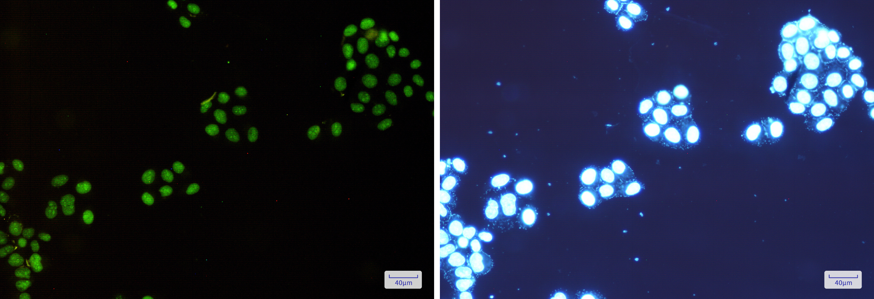 Immunofluorescence of NAT10(green) in Hela cells using NAT10 Rabbit mAb at dilution 1:200, and DAPI(blue)