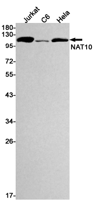 Western blot detection of NAT10 in Jurkat,C6,Hela cell lysates using NAT10 Rabbit mAb(1:1000 diluted).Predicted band size:116kDa.Observed band size:116kDa.