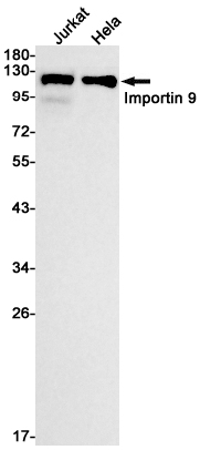 Western blot detection of Importin 9/RANBP9 in Jurkat,Hela cell lysates using Importin 9/RANBP9 Rabbit mAb(1:1000 diluted).Predicted band size:115kDa.Observed band size:115kDa.