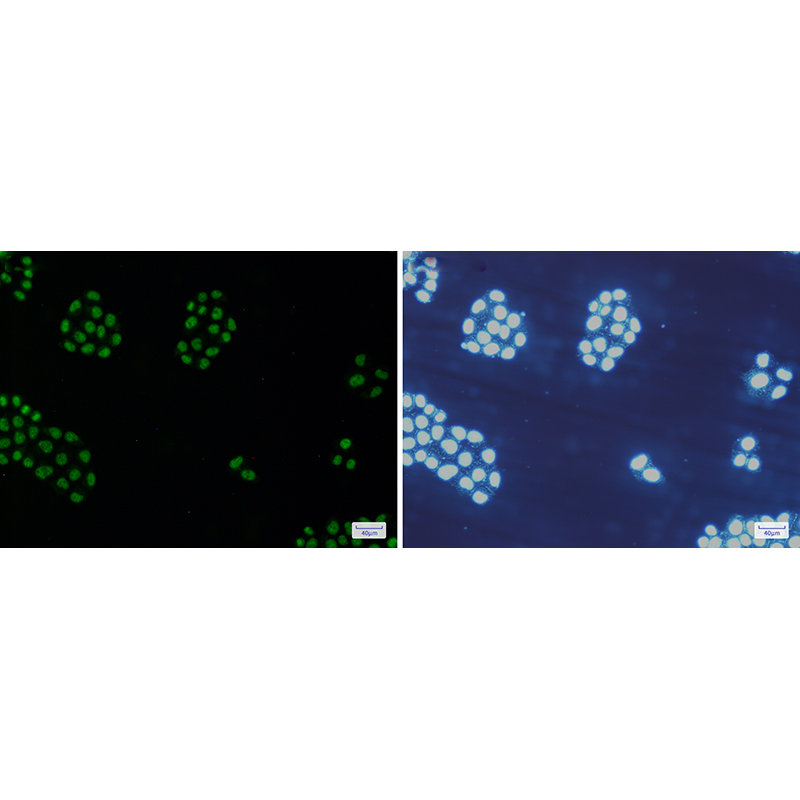 Immunofluorescence of MCM5(green) in Hela cells using MCM5 Rabbit mAb at dilution 1:200, and DAPI(blue)