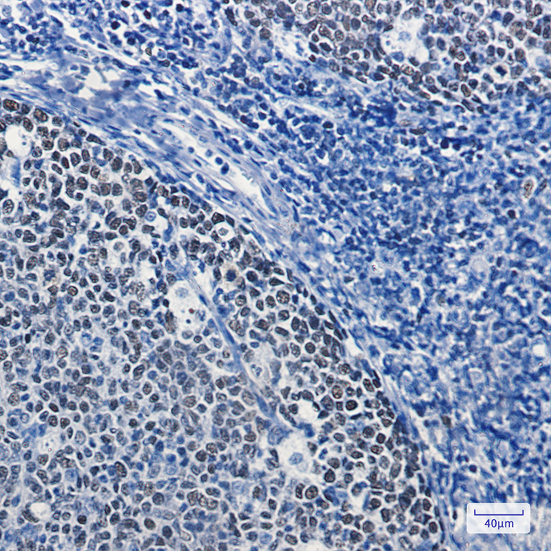 Immunohistochemistry of MCM5 in paraffin-embedded Human tonsil using MCM5 Rabbit mAb at dilution 1:100