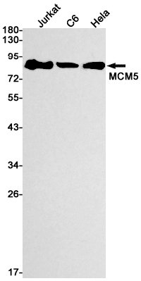 Western blot detection of MCM5 in Jurkat,C6,Hela cell lysates using MCM5 Rabbit mAb(1:1000 diluted).Predicted band size:82kDa.Observed band size:82kDa.