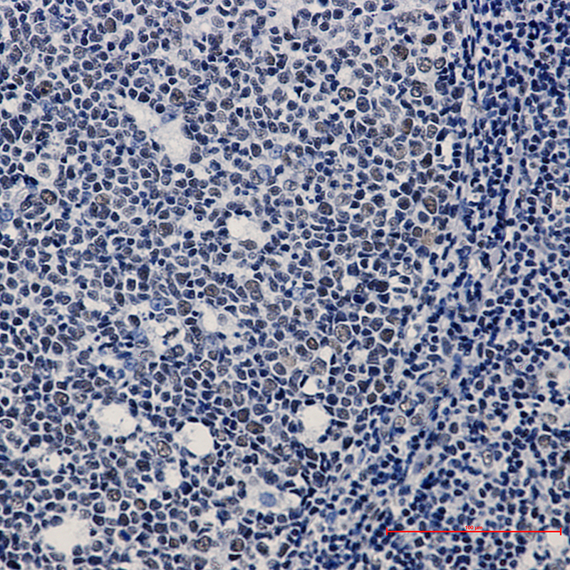 Immunohistochemistry of WTAP in paraffin-embedded Human tonsil using WTAP Rabbit mAb at dilution 1:20