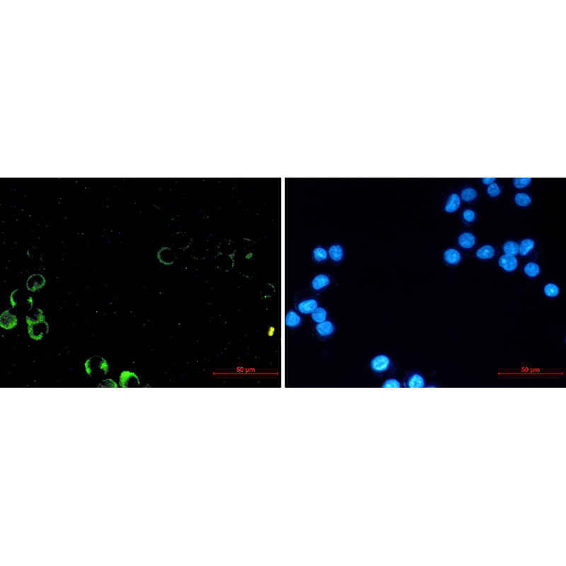 Immunofluorescence of PI3 Kinase p85 alpha (green) in MCF-7 using PI3 Kinase p85 alpha antibody at dilution 1:20, and DAPI(blue)