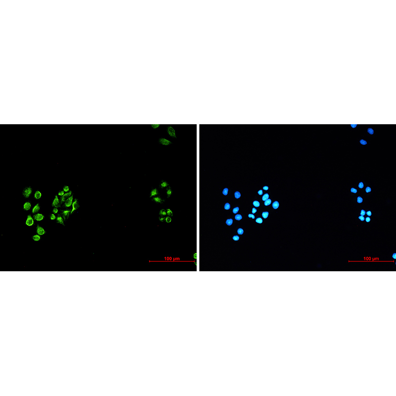 Immunofluorescence of Vimentin (green) in Hela using Vimentin antibody at dilution 1:20, and DAPI(blue)