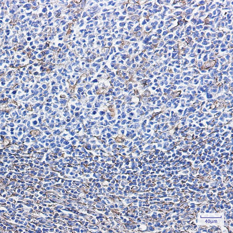 Immunohistochemistry of Vimentin in paraffin-embedded Human tonsil using Vimentin Rabbit mAb at dilution 1:100