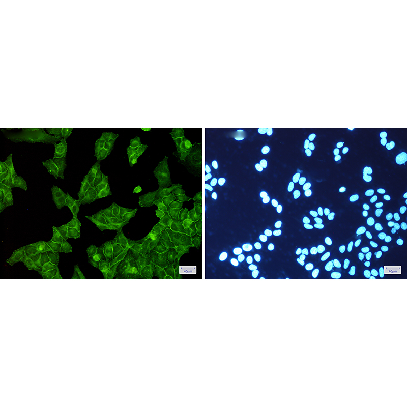 Immunofluorescence of EGFR(green) in Hela cells using EGFR Rabbit mAb at dilution 1:200, and DAPI(blue)