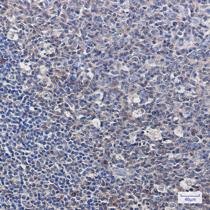 Immunohistochemistry of pro Caspase 3 in paraffin-embedded Human tonsil using pro Caspase 3 Rabbit mAb at dilution 1:100