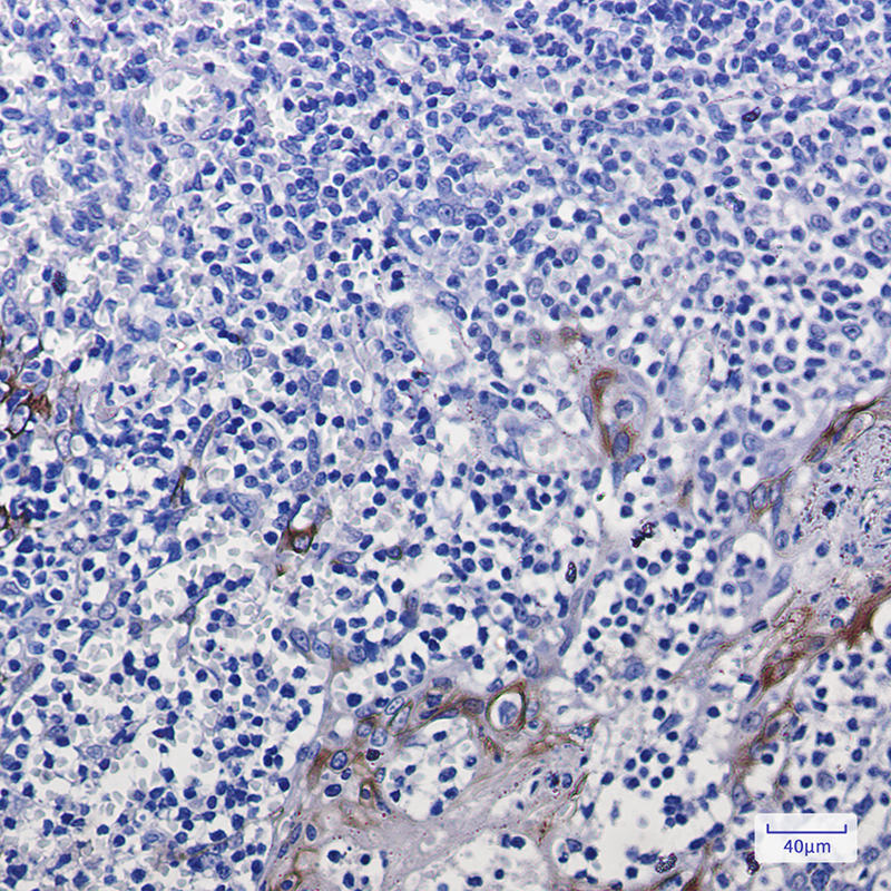 Immunohistochemistry of Cytokeratin 10 in paraffin-embedded Human tonsil using Cytokeratin 10 Rabbit mAb at dilution 1:100