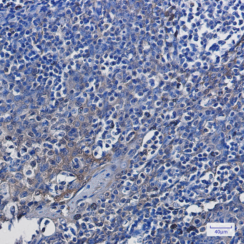 Immunohistochemistry of ENO1 in paraffin-embedded Human tonsil using ENO1 Rabbit mAb at dilution 1:100