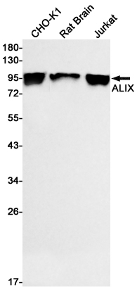 Western blot detection of ALIX in CHO-K1,Rat Brain,Jurkat cell lysates using ALIX Rabbit mAb(1:500 diluted).Predicted band size:96kDa.Observed band size:96kDa.