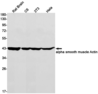 Western blot detection of alpha smooth muscle Actin in Rat Brain,C6,3T3,Hela cell lysates using alpha smooth muscle Actin Rabbit mAb(1:1000 diluted).Predicted band size:42kDa.Observed band size:42kDa.