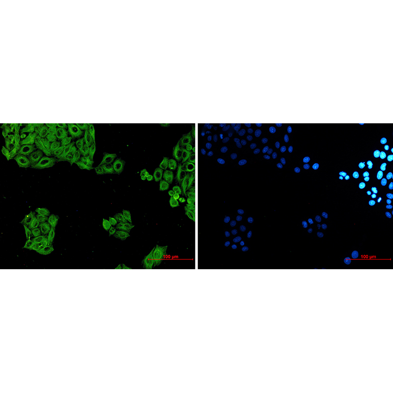 Immunofluorescence of alpha Tubulin(green) in hela using alpha Tubulin Rabbit mAb at dilution 1:50, and DAPI(blue)