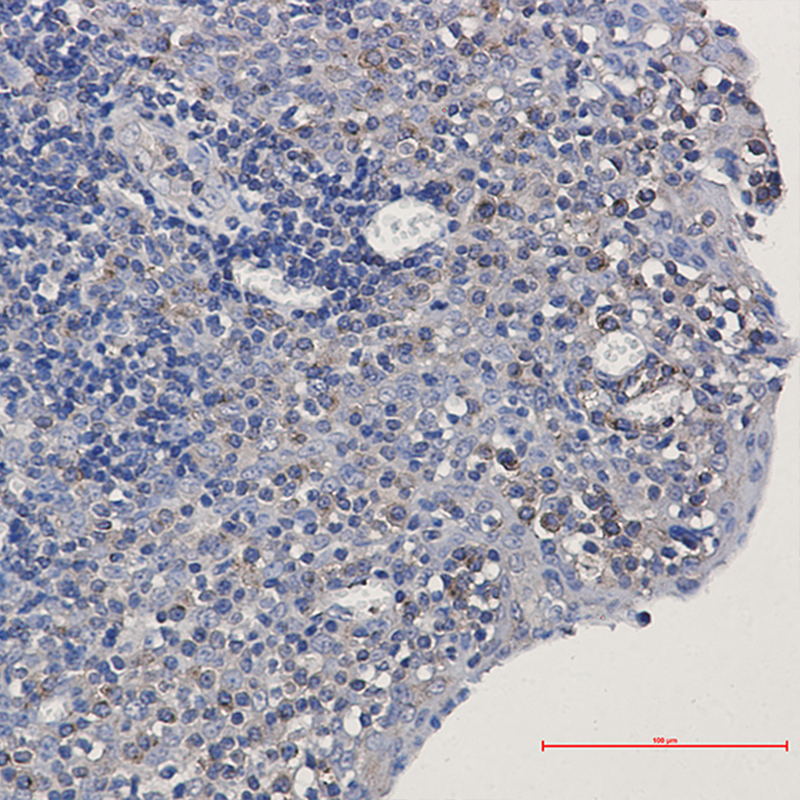 Immunohistochemistry of alpha Tubulin in paraffin-embedded Human tonsil using alpha Tubulin Rabbit mAb at dilution 1:50