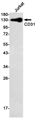 Western blot detection of CD31 in Jurkat cell lysates using CD31 Rabbit mAb(1:500 diluted).Predicted band size:83kDa.Observed band size:130kDa.