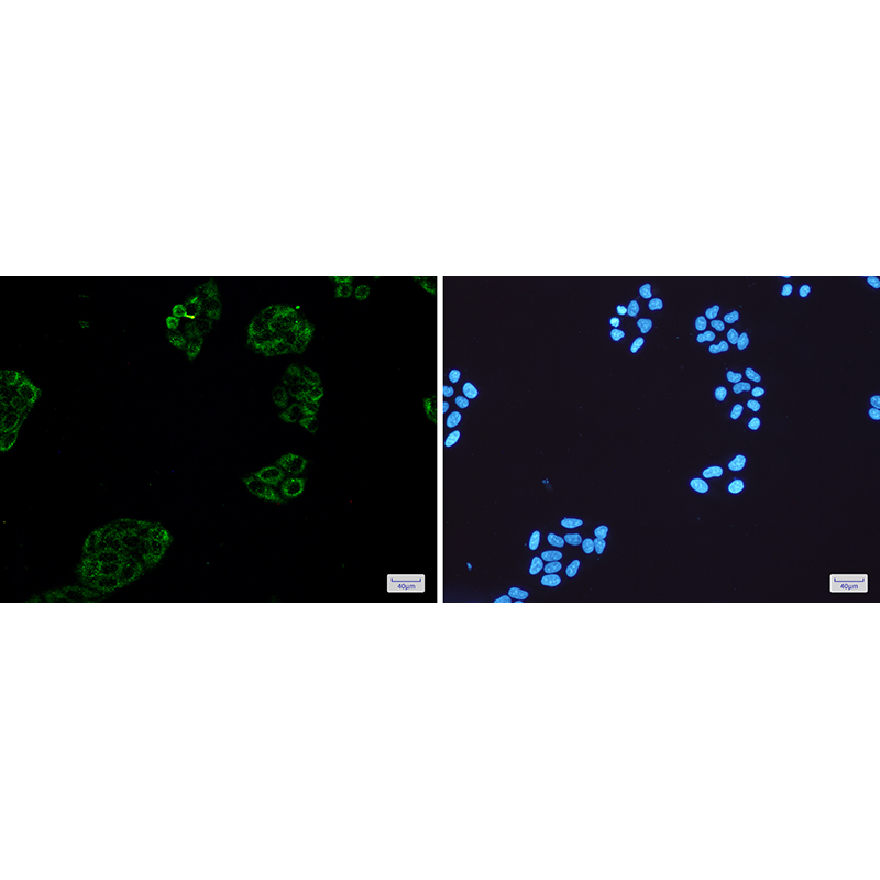 Immunofluorescence of Collagen III(green) in Hela cells using Collagen III Rabbit mAb at dilution 1:50, and DAPI(blue)