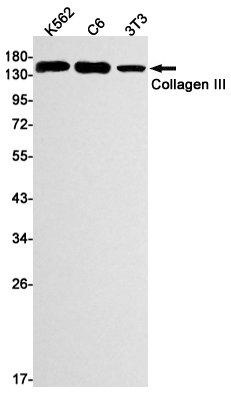 Western blot detection of Collagen III in K562,C6,3T3 cell lysates using Collagen III Rabbit mAb(1:1000 diluted).Predicted band size:139kDa.Observed band size:150kDa.