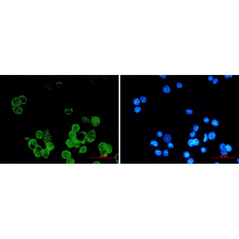 Immunofluorescence of Estrogen Receptor alpha (green) in MCF-7 using Estrogen Receptor alpha antibody at dilution 1:20, and DAPI(blue)