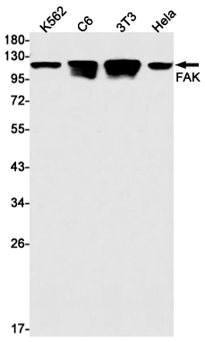 Western blot detection of FAK in K562,C6,3T3,Hela cell lysates using FAK Rabbit mAb(1:1000 diluted).Predicted band size:119kDa.Observed band size:125kDa.