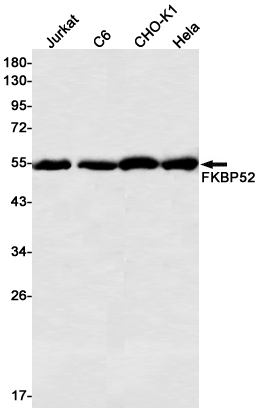Western blot detection of FKBP52 in Jurkat,C6,CHO-K1,Hela cell lysates using FKBP52 Rabbit mAb(1:500 diluted).Predicted band size:52kDa.Observed band size:52kDa.