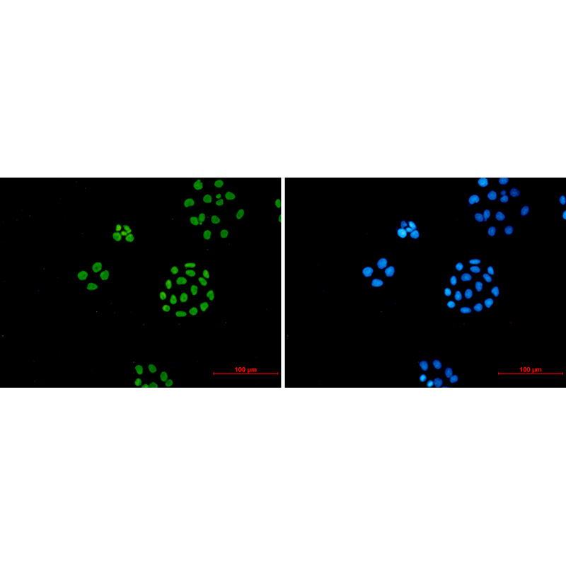 Immunofluorescence of ILF3(green) in hela using ILF3 Rabbit mAb at dilution 1:50, and DAPI(blue)