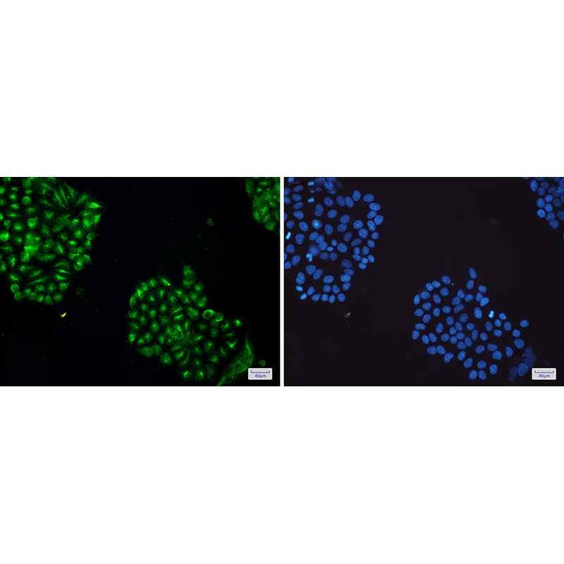 Immunofluorescence of JNK1/2/3 (green) in Hela cells using JNK1/2/3 Rabbit mAb at dilution 1:100, and DAPI(blue)