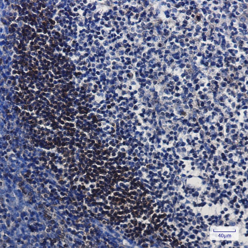 Immunohistochemistry of Leukotriene A4 hydrolase in paraffin-embedded Human tonsil using Leukotriene A4 hydrolase Rabbit mAb at dilution 1:50