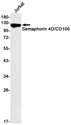 Western blot detection of Semaphorin 4D/CD100 in Jurkat cell lysates using Semaphorin 4D/CD100 Rabbit mAb(1:500 diluted).Predicted band size:96kDa.Observed band size:120kDa.