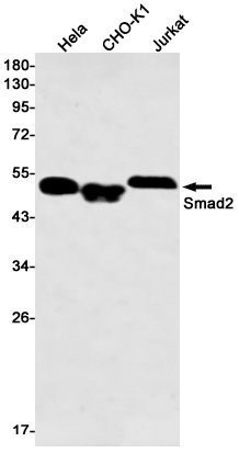 Western blot detection of Smad2 in Hela,CHO-K1,Jurkat cell lysates using Smad2 Rabbit mAb(1:500 diluted).Predicted band size:52kDa.Observed band size:52kDa.