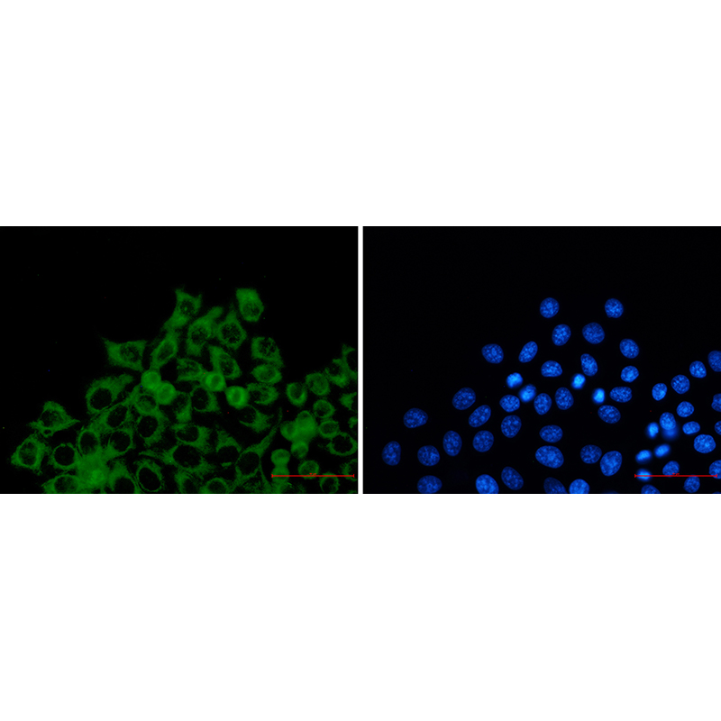 Immunofluorescence of TOMM2(green) in Hela using TOMM2 Rabbit mAb at dilution 1:50, and DAPI(blue)