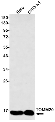 Western blot detection of TOMM20 in Hela,CHO-K1 cell lysates using TOMM20 Rabbit mAb(1:500 diluted).Predicted band size:16kDa.Observed band size:16kDa.
