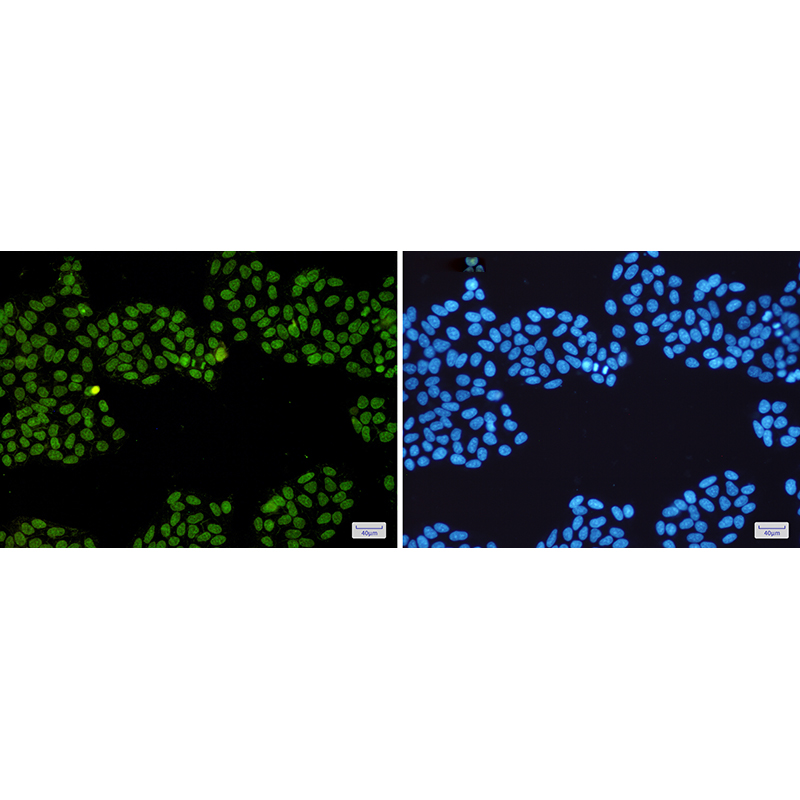 Immunofluorescence of Topoisomerase I(green) in Hela cells using Topoisomerase I Rabbit mAb at dilution 1:200, and DAPI(blue)