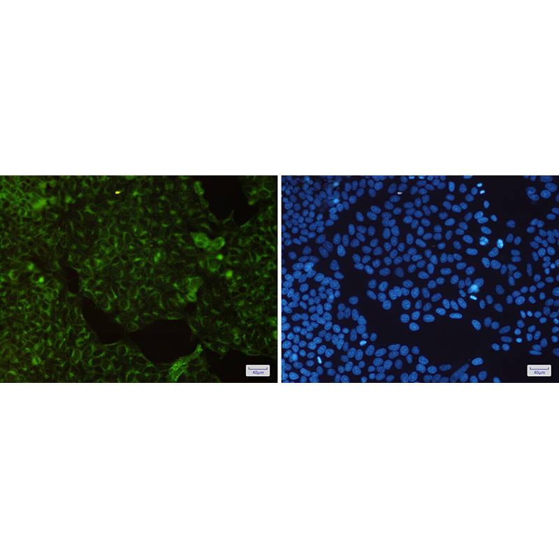 Immunofluorescence of Transferrin Receptor(green) in Hela cells using Transferrin Receptor Rabbit mAb at dilution 1:200, and DAPI(blue)