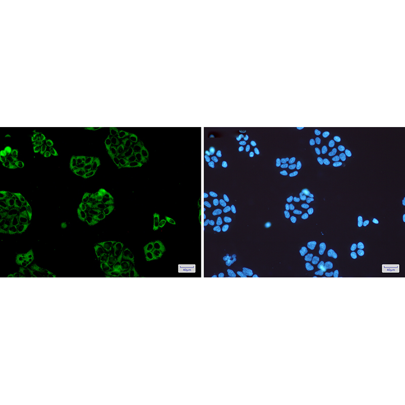 Immunofluorescence of Vinculin(green) in Hela cells using Vinculin Rabbit mAb at dilution 1:50, and DAPI(blue)