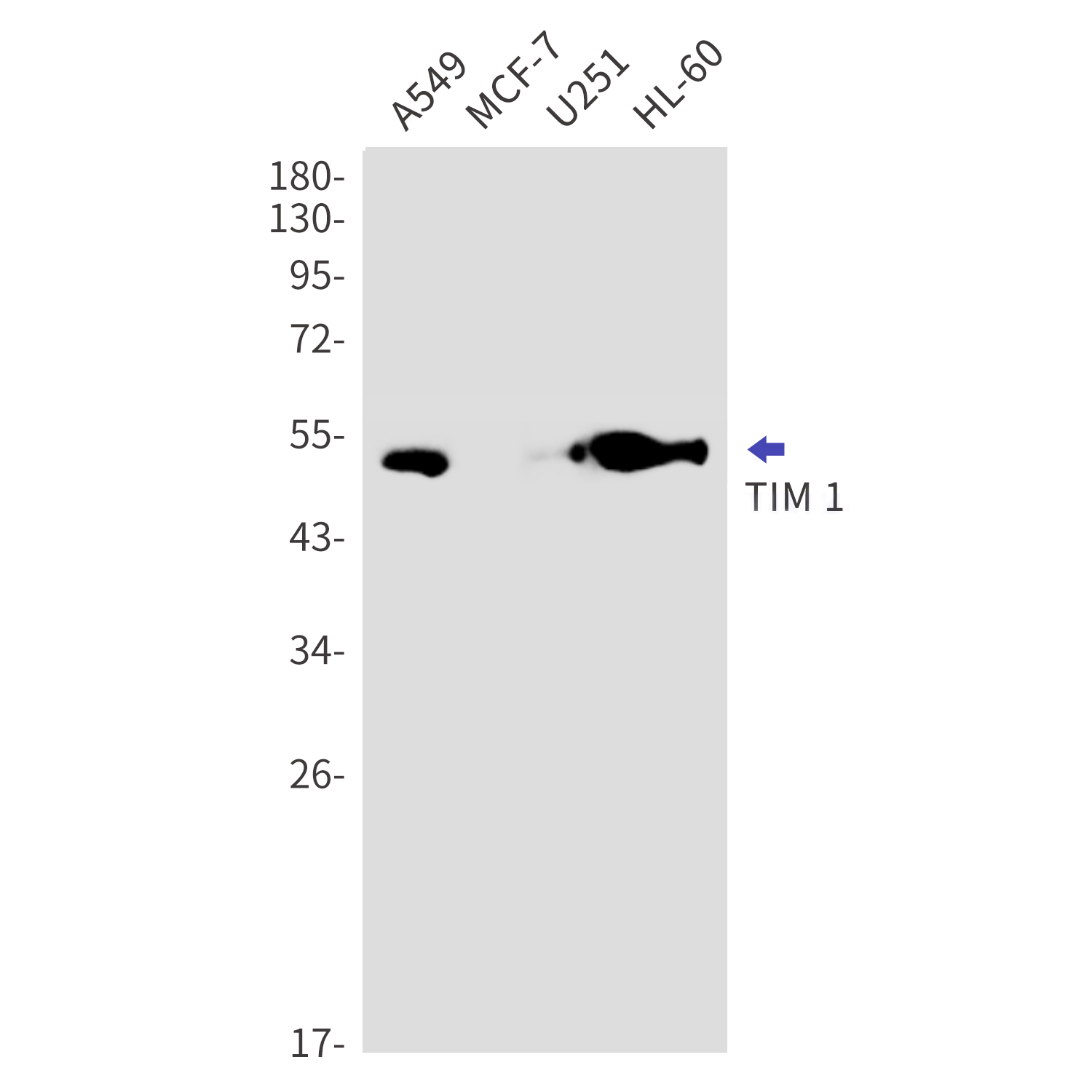 Western blot detection of TIM 1 in A549,MCF-7,U251,HL-60 cell lysates using TIM 1 Rabbit mAb(1:1000 diluted).Predicted band size:39kDa.Observed band size:50kDa.