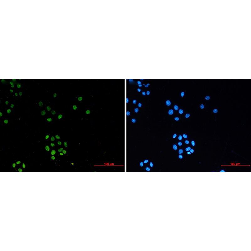 Immunofluorescence of TriMethyl-Histone H3 (Lys27) (green) in Hela using TriMethyl-Histone H3 (Lys27) antibody at dilution 1/20, and DAPI(blue)