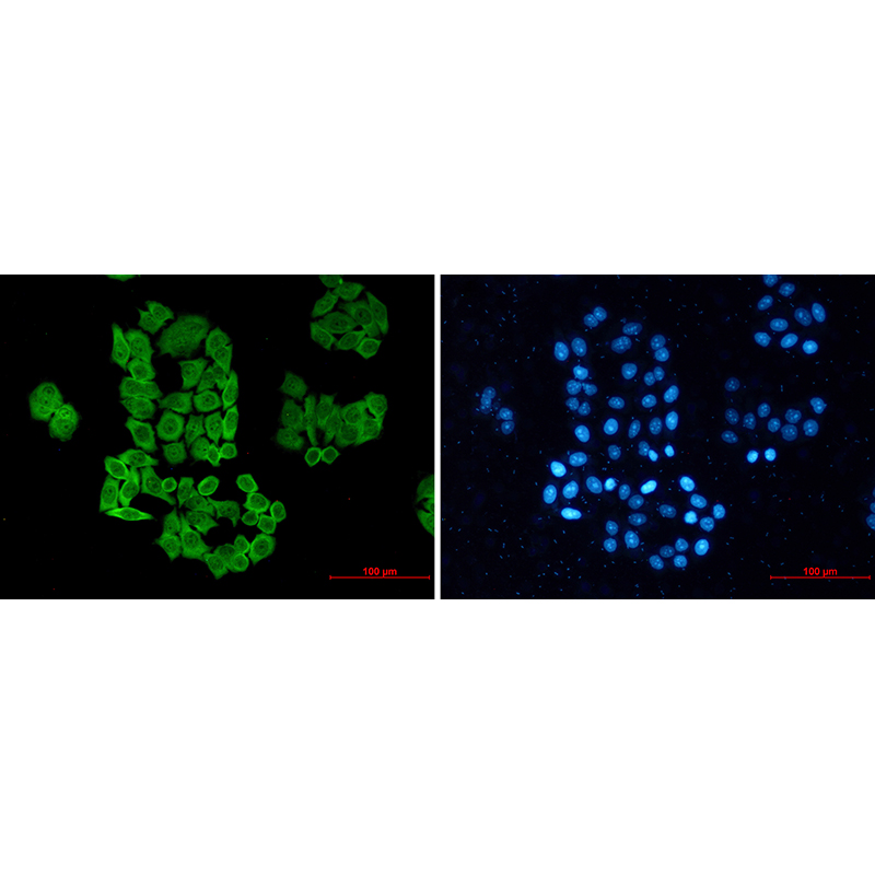 Immunofluorescence of CCT2(green) in hela using CCT2 Rabbit mAb at dilution 1:50, and DAPI(blue)