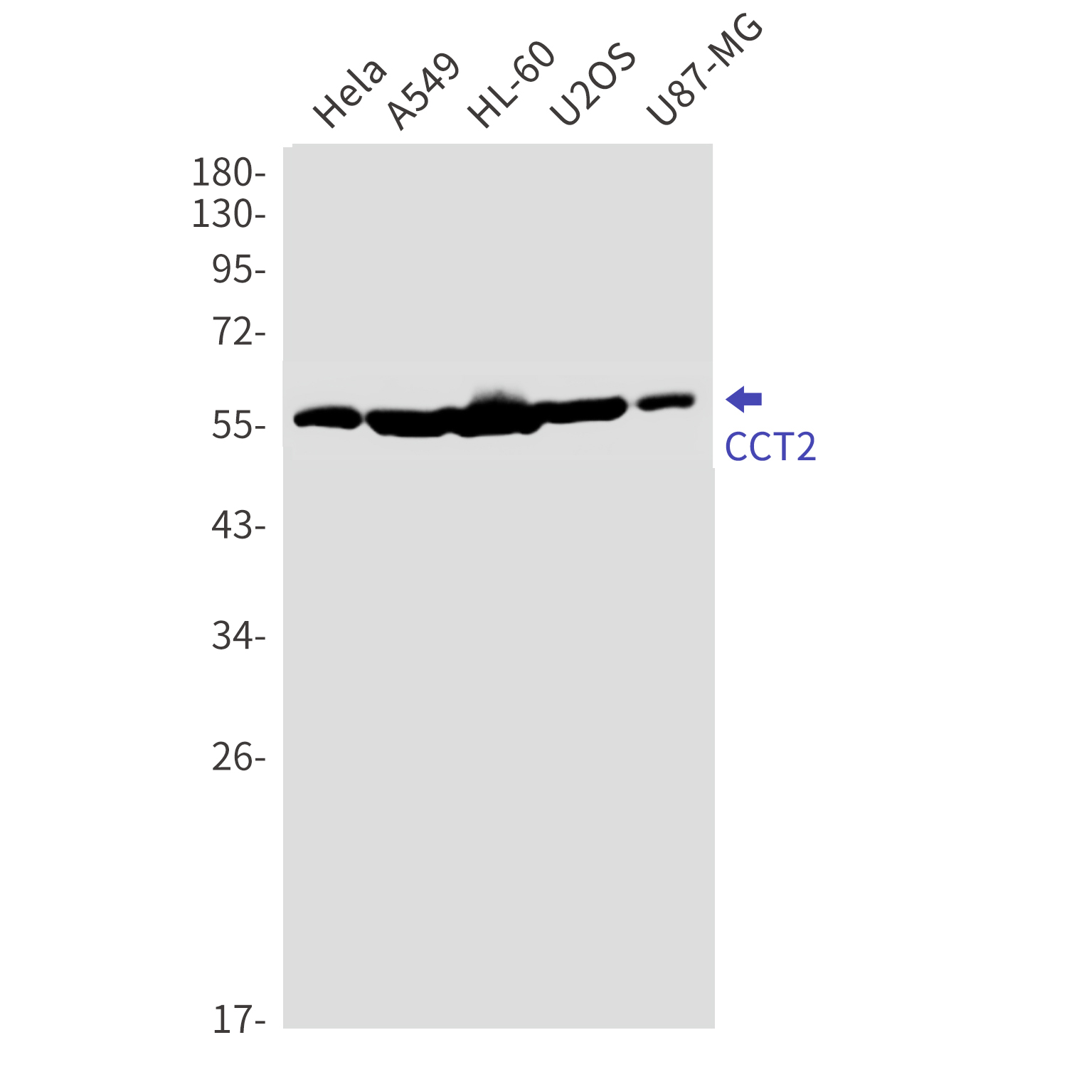Western blot detection of CCT2 in Hela,A549,HL-60,U2OS,U87-MG cell lysates using CCT2 Rabbit mAb(1:1000 diluted).Predicted band size:57kDa.Observed band size:57kDa.