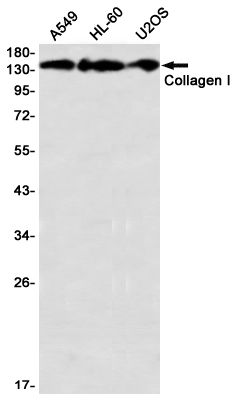 Western blot detection of Collagen I in A549,HL-60,U2OS using Collagen I Rabbit mAb(1:1000 diluted)