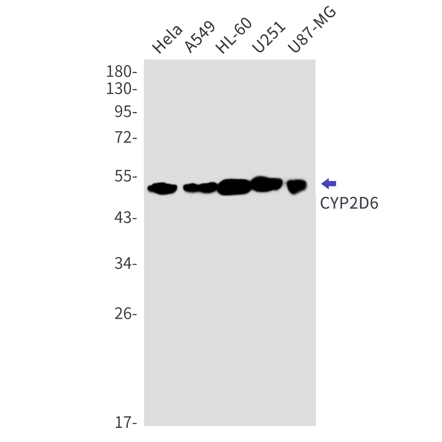Western blot detection of CYP2D6 in Hela,A549,HL-60,U251,U87-MG cell lysates using CYP2D6 Rabbit mAb(1:1000 diluted).Predicted band size:56kDa.Observed band size:50kDa.