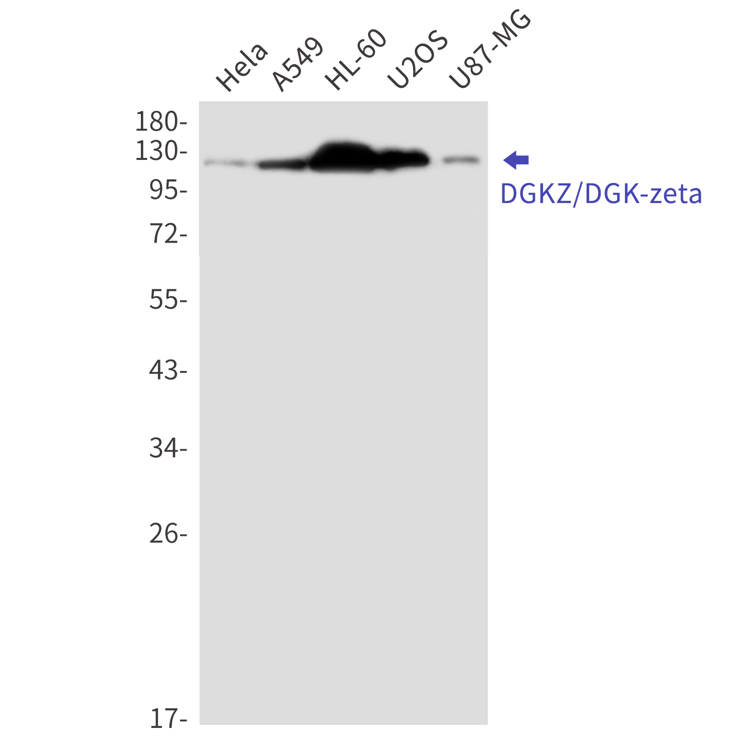 Western blot detection of DGKZ/DGK-zeta in Hela,A549,HL-60,U2OS,U87-MG cell lysates using DGKZ/DGK-zeta Rabbit mAb(1:1000 diluted).Predicted band size:104kDa.Observed band size:124,114kDa.