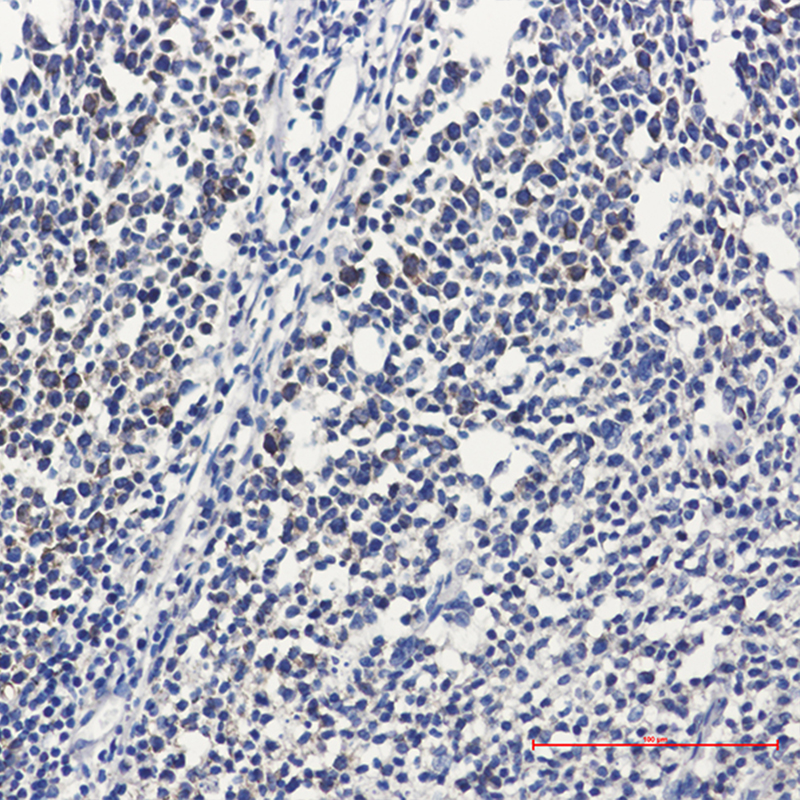 Immunohistochemistry of RPS20 in paraffin-embedded Human tonsil using RPS20 Rabbit mAb at dilution 1:50