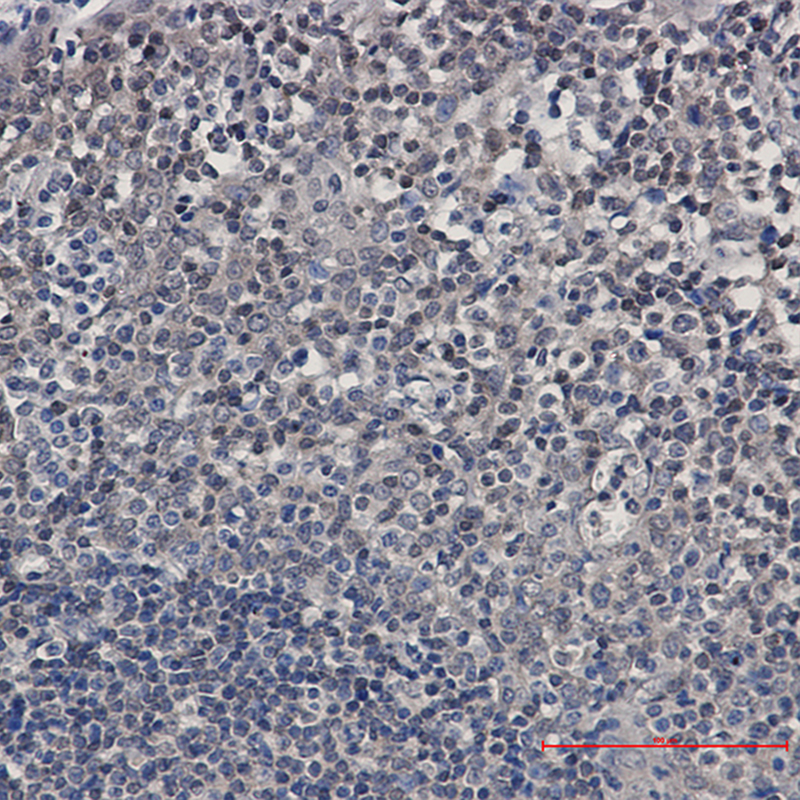 Immunohistochemistry of UBE2I/UBC9 in paraffin-embedded Human tonsil using UBE2I/UBC9 Rabbit mAb at dilution 1:50