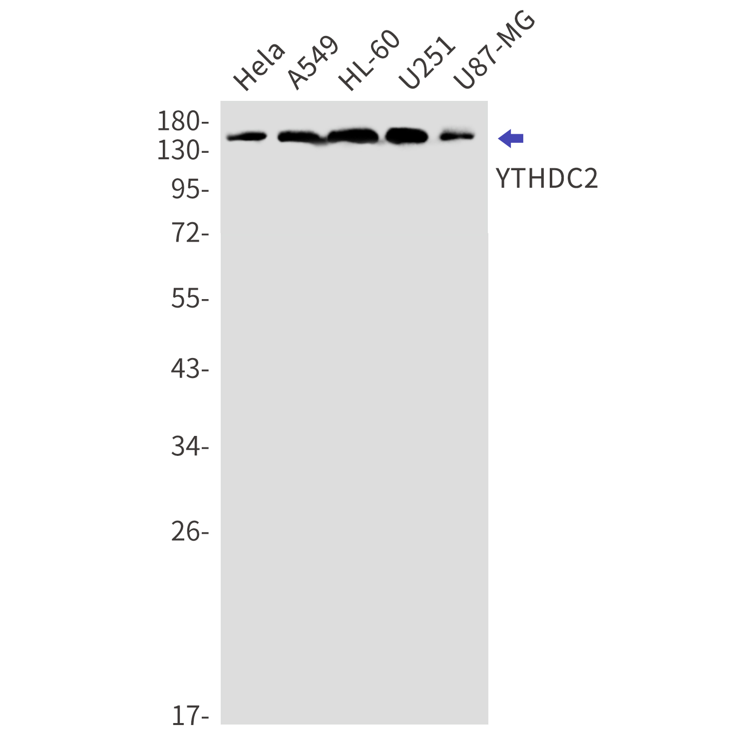 Western blot detection of YTHDC2 in Hela,A549,HL-60,U251,U87-MG cell lysates using YTHDC2 Rabbit mAb(1:1000 diluted).Predicted band size:160kDa.Observed band size:160kDa.