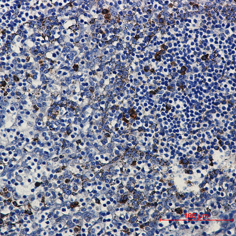 Immunohistochemical of PKC beta 2 in Human tonsil tissue using PKC beta 2 antibody at dilution 1:50