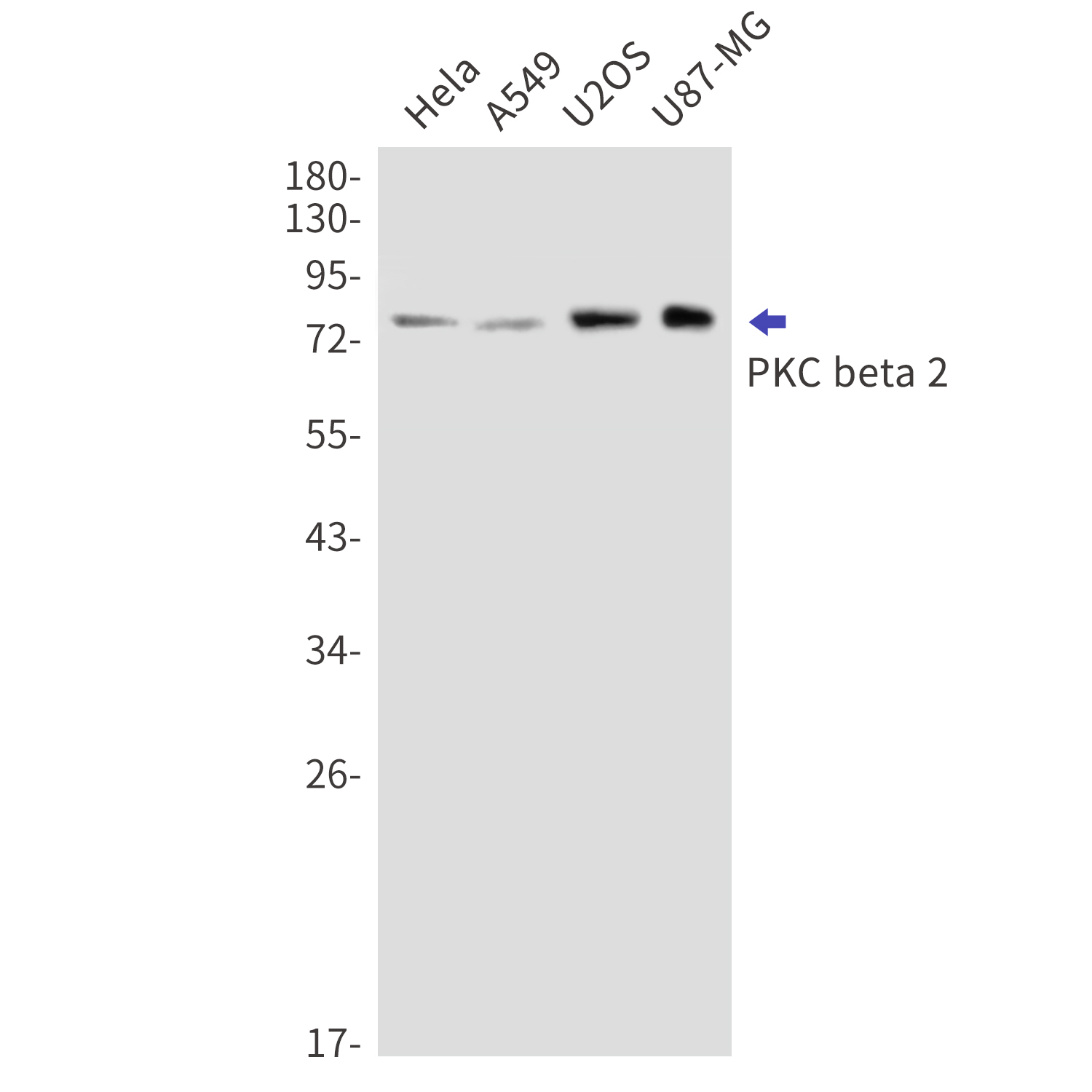 Western blot detection of PKC beta 2 in Hela,A549,U2OS,U87-MG cell lysates using PKC beta 2 Rabbit mAb(1:1000 diluted).Observed band size:77kDa.
